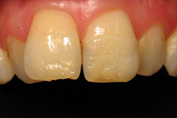 Teeth