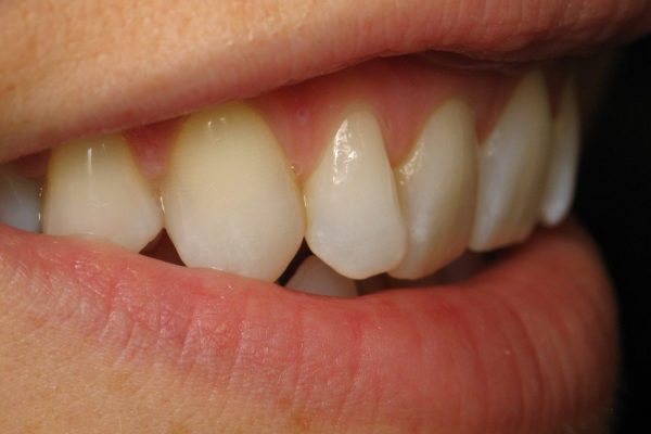 Teeth