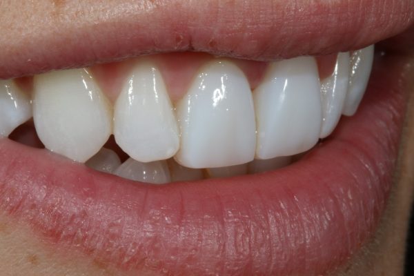 Teeth