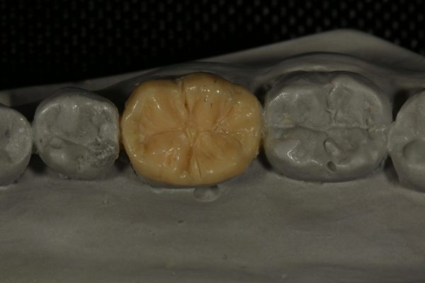 Teeth