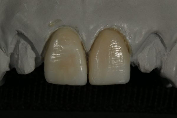Teeth