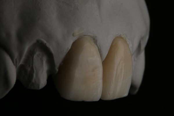 Teeth