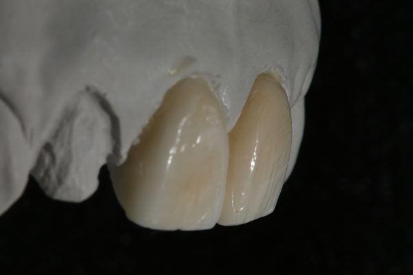 Teeth