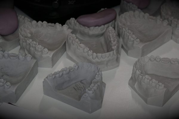 Teeth